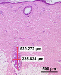 coag02